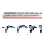 Scherback Speculum 90mm x 40mm Vaginal Specula GY 12-290-03